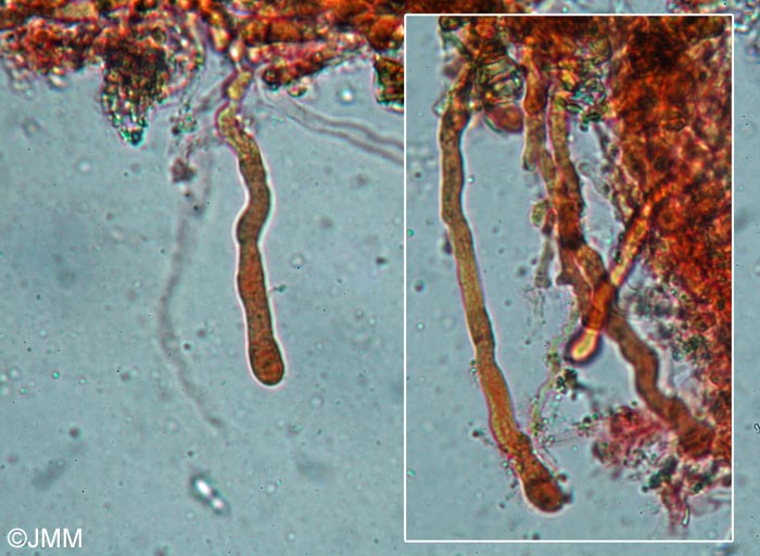Vuilleminia coryli : microscopie