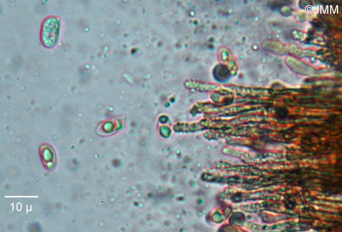 Merismodes anomala : microscopie