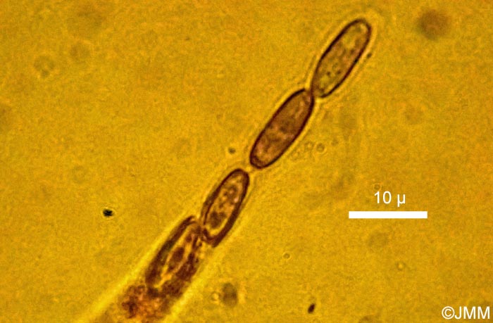 Biporispora europaea